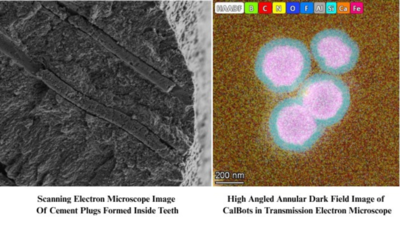 Microscopic-images-of-CalBots-inside-teeth-Credit-IISc.jpg