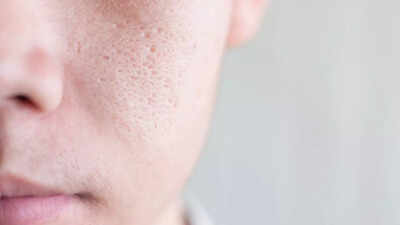 8-effective-tips-to-reduce-large-pores-for-smoother-skin.jpg