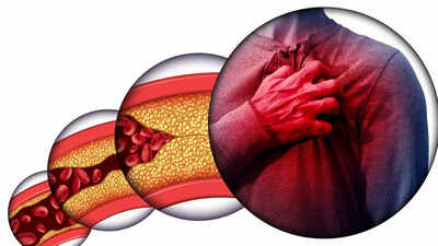 atherosclerosis-early-signs-in-young-adults-linked-to-diabetes-and-obesity.jpg