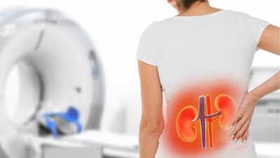 silent-killer-woman-shares-common-signs-of-kidney-failure-she-ignored.jpg