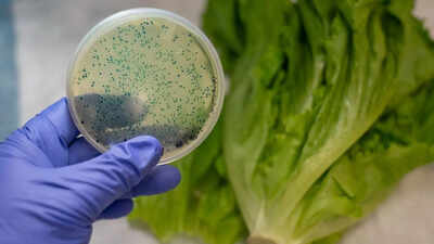 6-kitchen-mistakes-that-could-expose-you-to-harmful-e-coli-and-cause-serious-infections.jpg