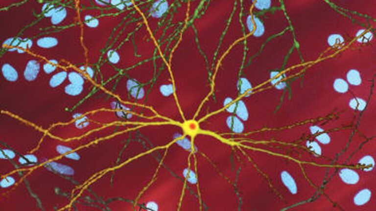 Neuron_with_mHtt_inclusion.jpg