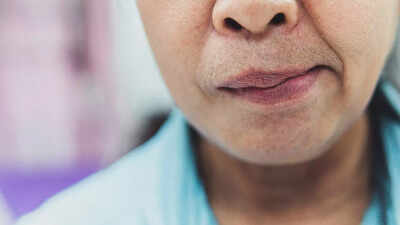 facial-paralysis-warning-signs-key-causes-symptoms-and-prevention-steps-you-need-to-know.jpg