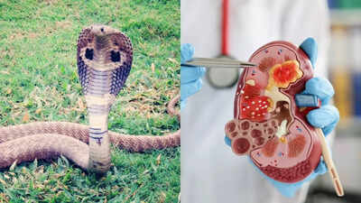 snake-urine-could-cure-kidney-stones-and-gout-pain-scientists-reveal.jpg