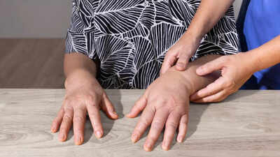 what-causes-swelling-in-fingers-know-8-common-reasons-behind-it.jpg