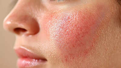 5-skin-signs-of-liver-damage-you-should-not-ignore.jpg