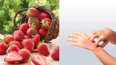 can-strawberries-cause-allergies-know-the-signs-causes-and-how-to-manage-them.jpg