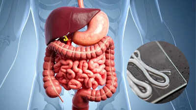 spotting-worms-in-your-poop-how-to-identify-the-types-causes-and-symptoms.jpg