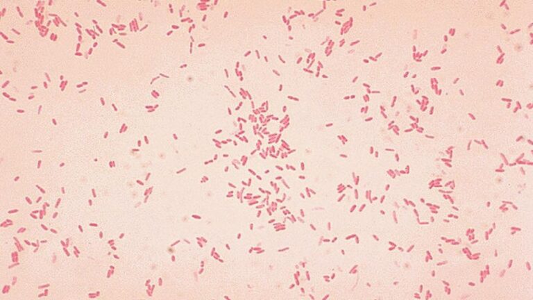 Aeromonas_hydrophila.jpg