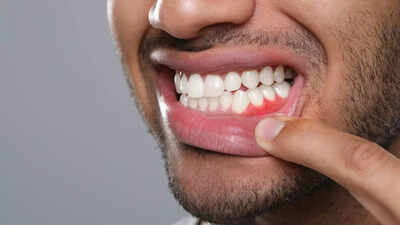 gum-diseases-may-affect-more-than-teeth-how-poor-oral-health-raises-stroke-risk-key-tips-to-protect.jpeg